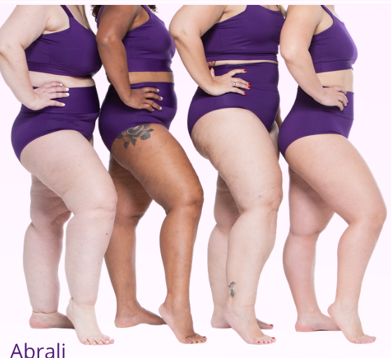Mulheres com lipedema em diferentes tipos de corpo — campanha Abrali sobre lipedema